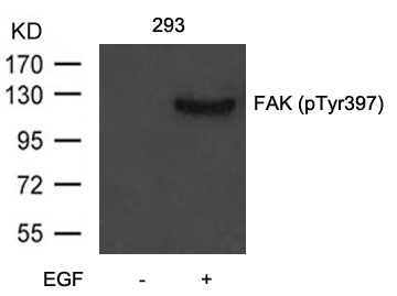 FAK (Phospho-Tyr397) Antibody