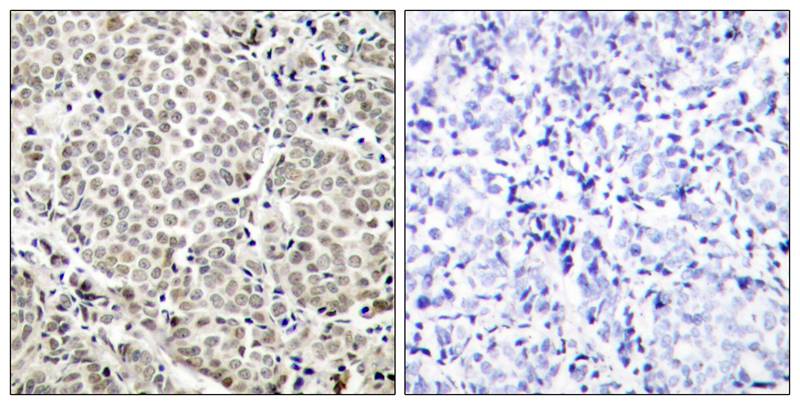 NFκB-p65 (Phospho-Ser529) Antibody