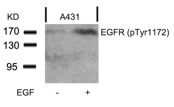 EGFR (Phospho-Tyr1172) Antibody