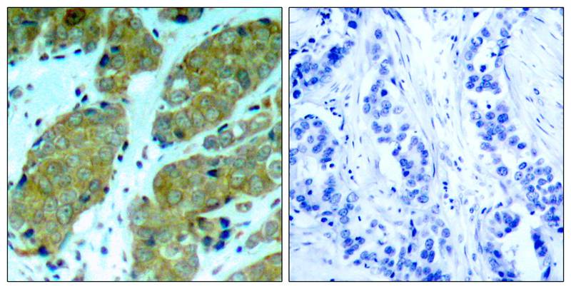 mTOR (Phospho-Ser2448) Antibody
