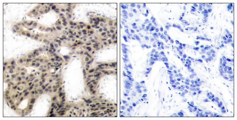 4E-BP1 (Phospho-Thr46) Antibody