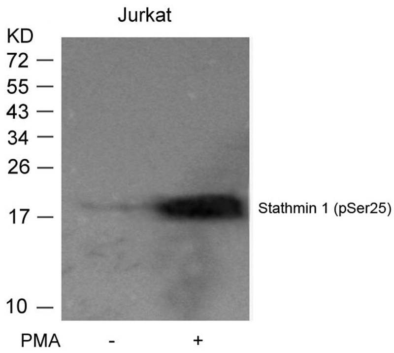 Stathmin 1 (Phospho-Ser25) Antibody