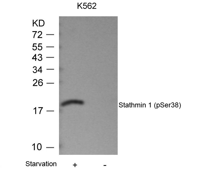 Stathmin 1 (Phospho-Ser38) Antibody