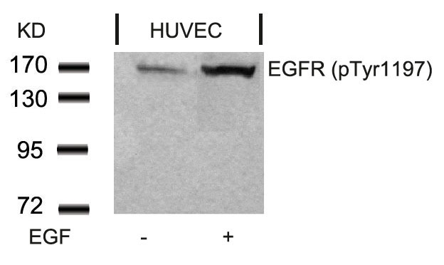 EGFR (Phospho-Tyr1197) Antibody