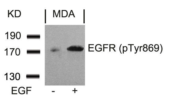 EGFR (Phospho-Tyr869) Antibody