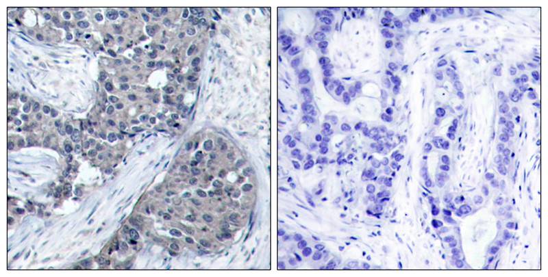 eIF4E (Phospho-Ser209) Antibody