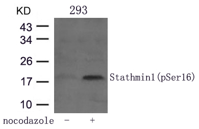 Stathmin 1 (Phospho-Ser16) Antibody