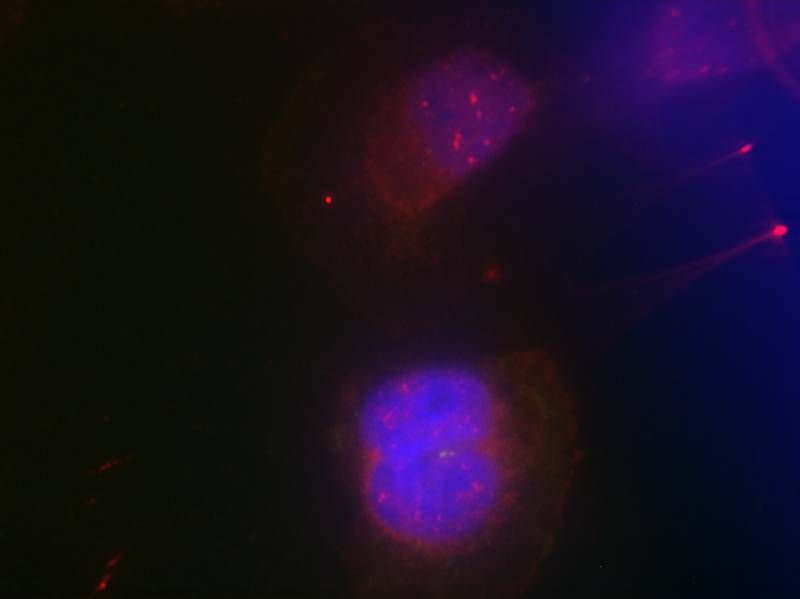 BRCA1 (Phospho-Ser988) Antibody