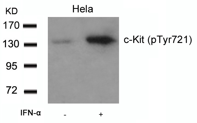 c-Kit (Phospho-Tyr721) Antibody