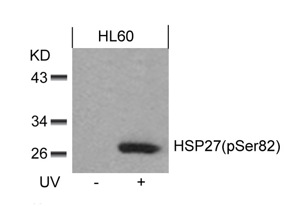 HSP27 (Phospho-Ser82) Antibody