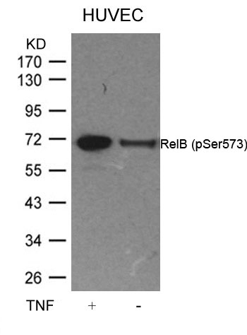 RelB (Phospho-Ser573) Antibody
