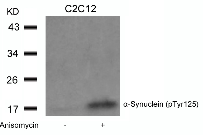 α-Synuclein (Phospho-Tyr125) Antibody