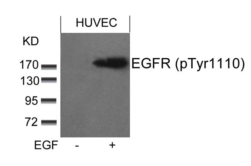 EGFR (phospho-Tyr1110) Antibody