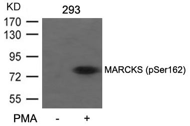 MARCKS (Phospho-Ser162) Antibody