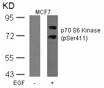 p70 S6 Kinase (Phospho-Ser411) Antibody