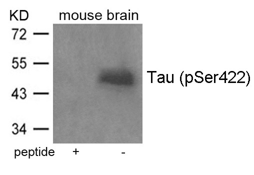 Tau (Phospho-Ser422) Antibody