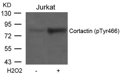 Cortactin (Phospho-Tyr466) Antibody