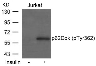 p62Dok (phospho-Tyr362) Antibody