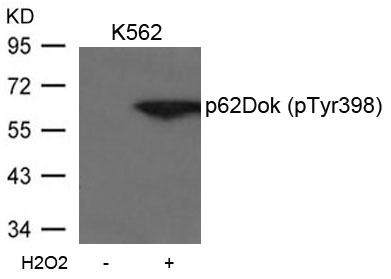 p62Dok (phospho-Tyr398) Antibody