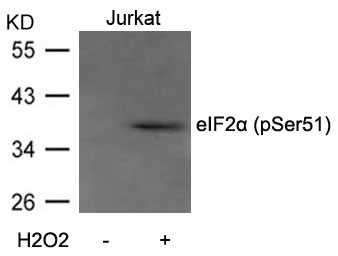 eIF2α (Phospho-Ser51) Antibody