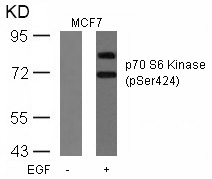 p70 S6 Kinase (Phospho-Ser424) Antibody