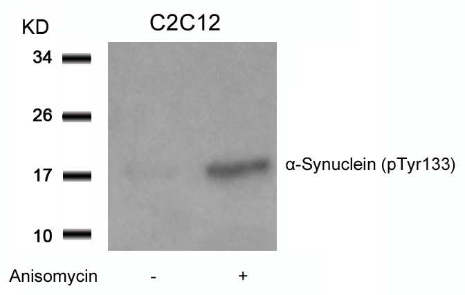 α-Synuclein (Phospho-Tyr133) Antibody