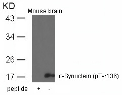 α-Synuclein (Phospho-Tyr136) Antibody