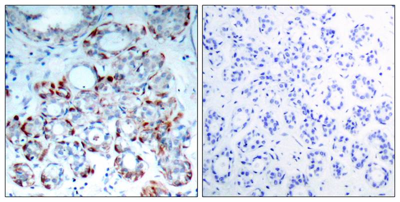 BIM (Phospho-Ser69) Antibody