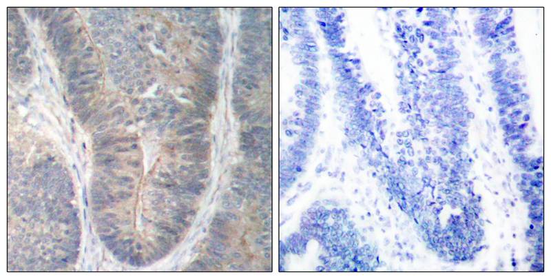 PKR (Phospho-Thr451) Antibody