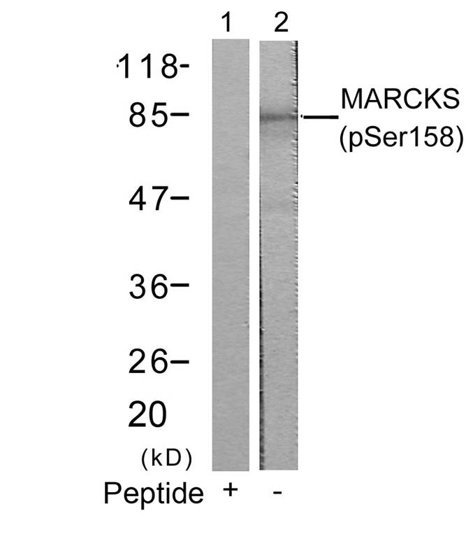 MARCKS (Phospho-Ser158) Antibody
