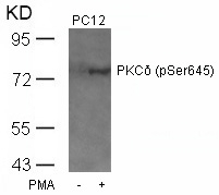 PKCδ (Phospho-Ser645) Antibody