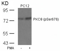 PKCθ (Phospho-Ser676) Antibody