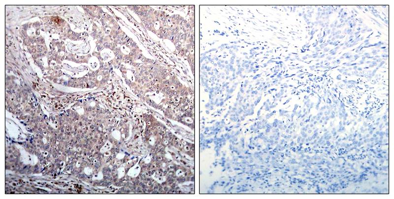 IκB-β (Phospho-Ser23) Antibody