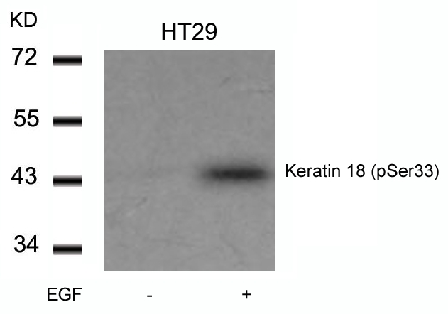 Keratin 18 (Phospho-Ser33) Antibody