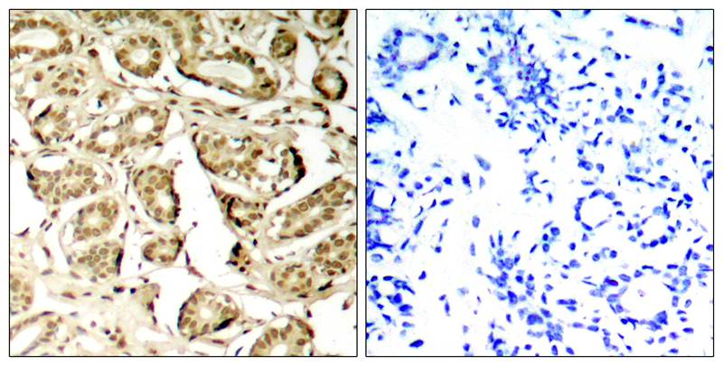 MEF2A (Phospho-Ser408) Antibody