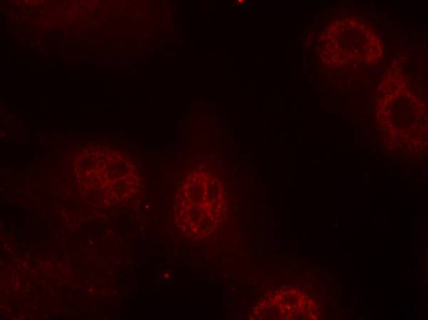 Myc (Phospho-Ser62) Antibody