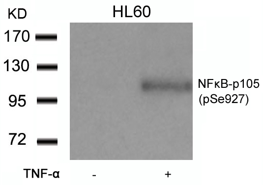NFκB-p105(Phospho-Ser927) Antibody