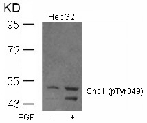 Shc1 (Phospho-Tyr349) Antibody