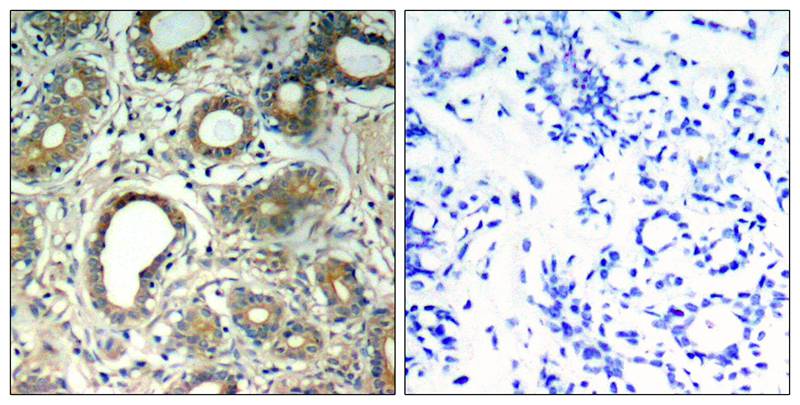 SHP-2 (Phospho-Tyr580) Antibody