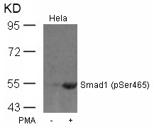 Smad1 (Phospho-Ser465) Antibody