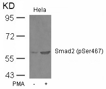Smad2 (Phospho-Ser467) Antibody