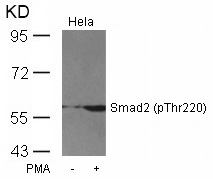 Smad2 (Phospho-Thr220) Antibody