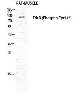 TrkB (Phospho-Tyr515) Antibody