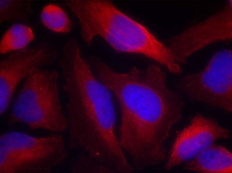 Tyrosine Hydroxylase (Phospho-Ser19) Antibody