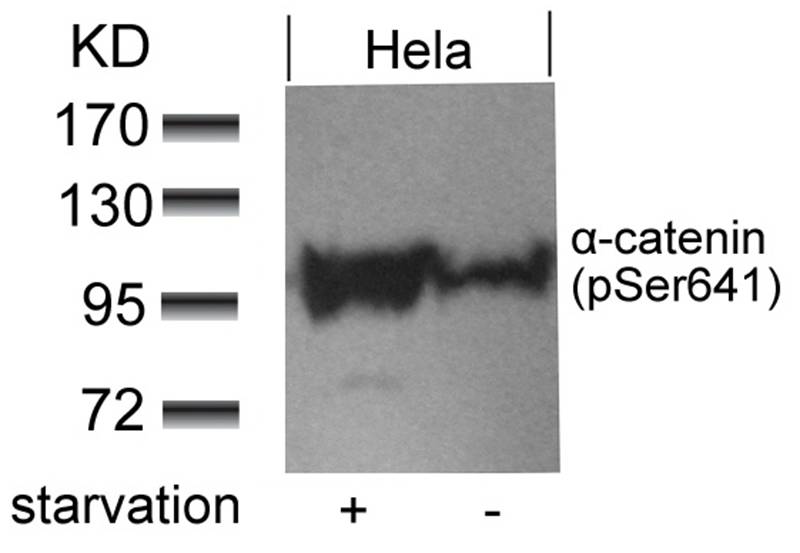 α-catenin (Phospho-Ser641) Antibody