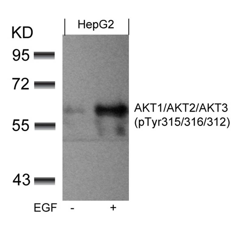 AKT1/AKT2/AKT3 (phospho-Tyr315/316/312) Antibody