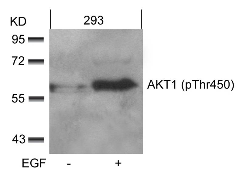 AKT1 (phospho-Thr450) Antibody