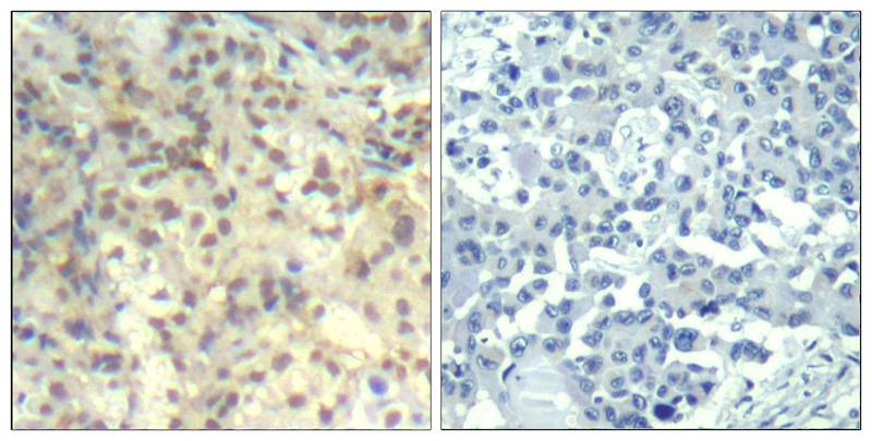 cofilin1 (phospho-Tyr139) Antibody