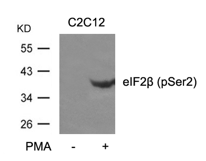 eIF2β (phospho-Ser2) Antibody