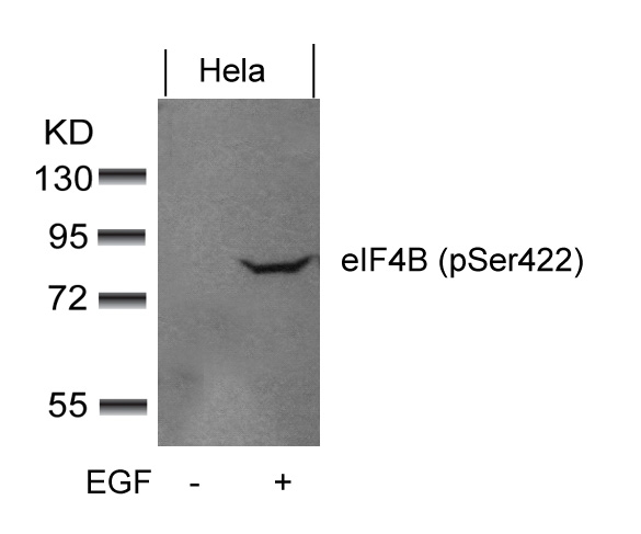eIF4B (phospho-Ser422) Antibody